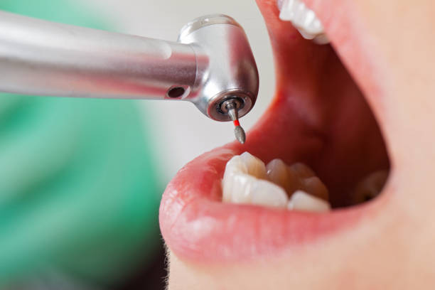 Best Pediatric Emergency Dentist in West Monroe, LA